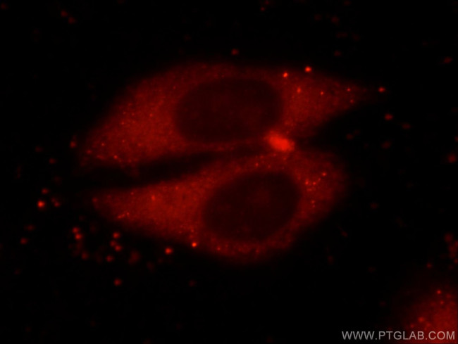 PRDX1 Antibody in Immunocytochemistry (ICC/IF)