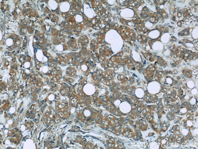 PRDX1 Antibody in Immunohistochemistry (Paraffin) (IHC (P))