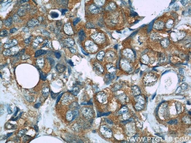 PRDX1 Antibody in Immunohistochemistry (Paraffin) (IHC (P))