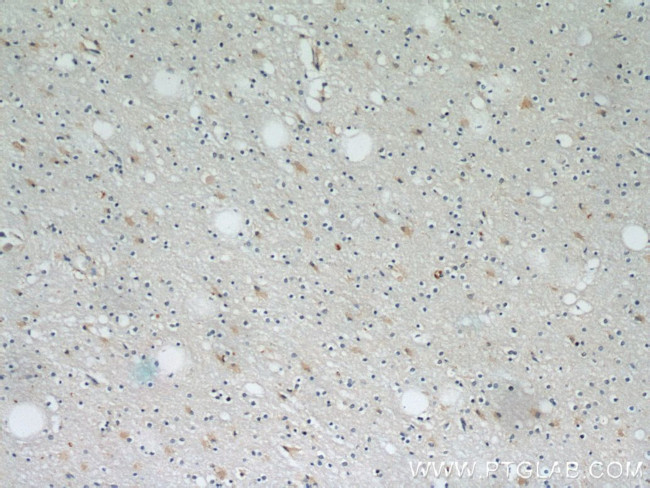 PRDX1 Antibody in Immunohistochemistry (Paraffin) (IHC (P))