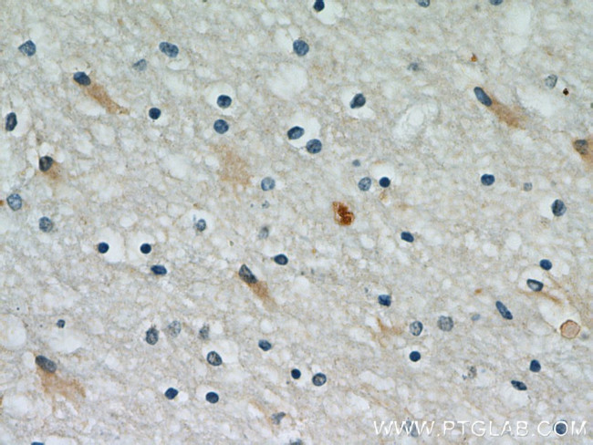 PRDX1 Antibody in Immunohistochemistry (Paraffin) (IHC (P))