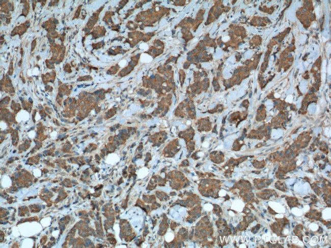 PRDX1 Antibody in Immunohistochemistry (Paraffin) (IHC (P))