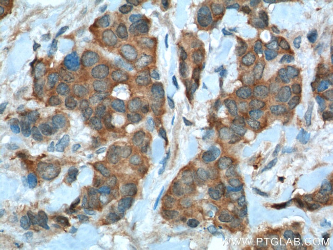 PRDX1 Antibody in Immunohistochemistry (Paraffin) (IHC (P))