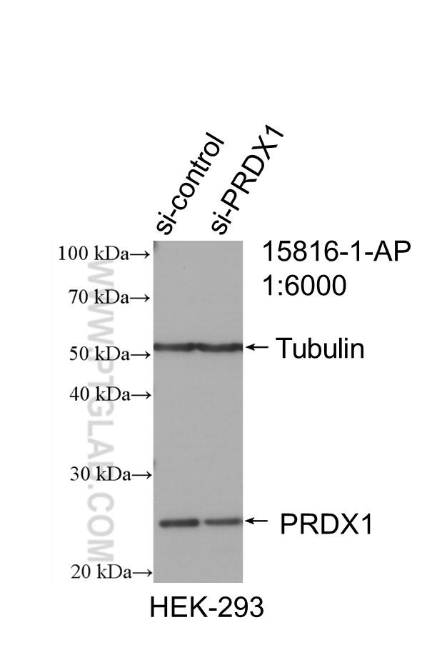 PRDX1 Antibody in Western Blot (WB)