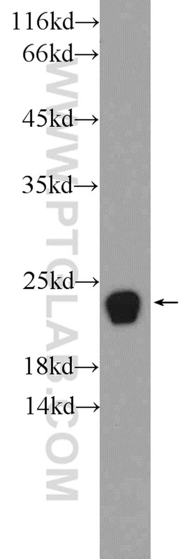 PRDX1 Antibody in Western Blot (WB)