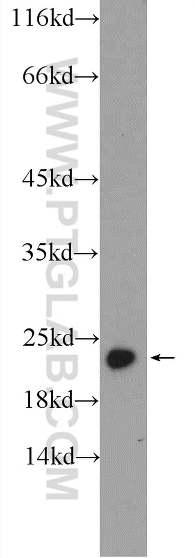 PRDX1 Antibody in Western Blot (WB)