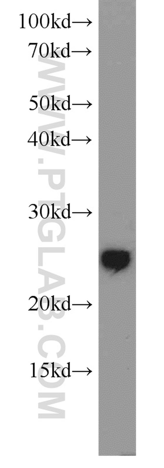 PRDX1 Antibody in Western Blot (WB)