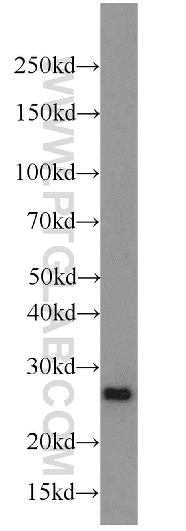 PRDX1 Antibody in Western Blot (WB)