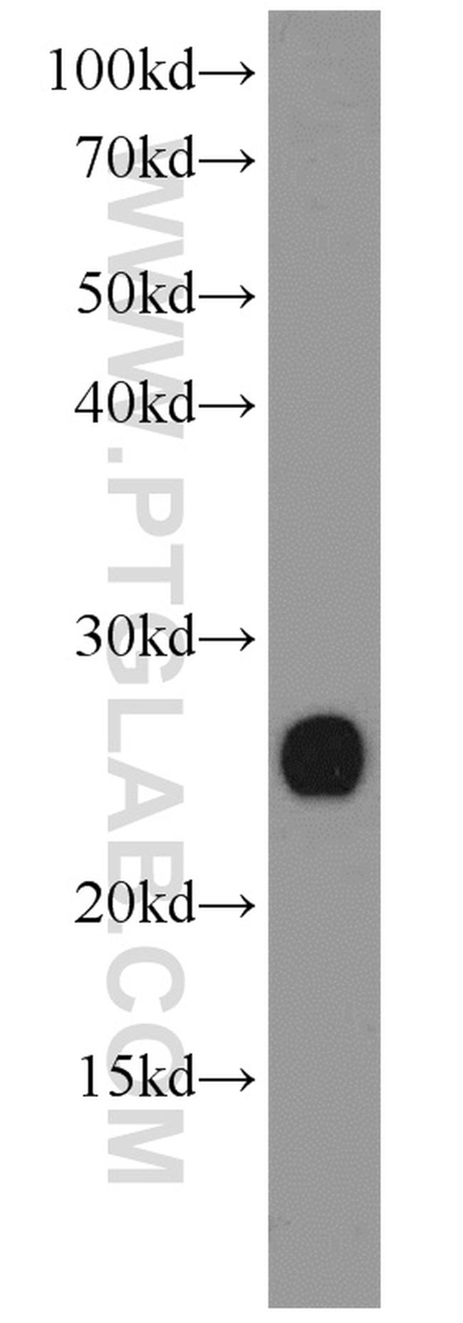 PRDX1 Antibody in Western Blot (WB)