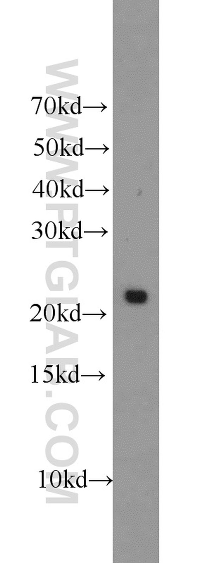 PRDX1 Antibody in Western Blot (WB)