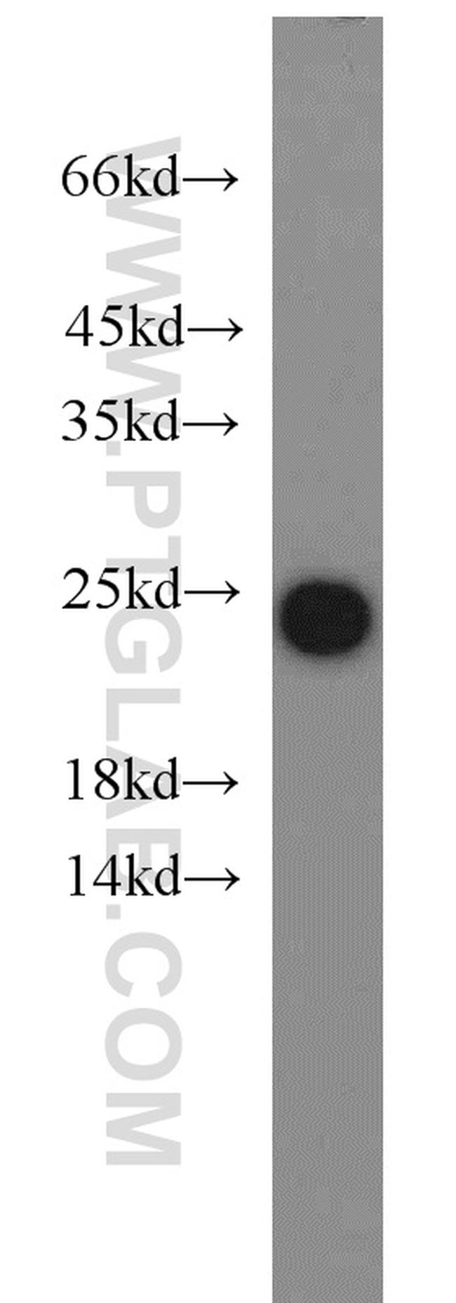 PRDX1 Antibody in Western Blot (WB)