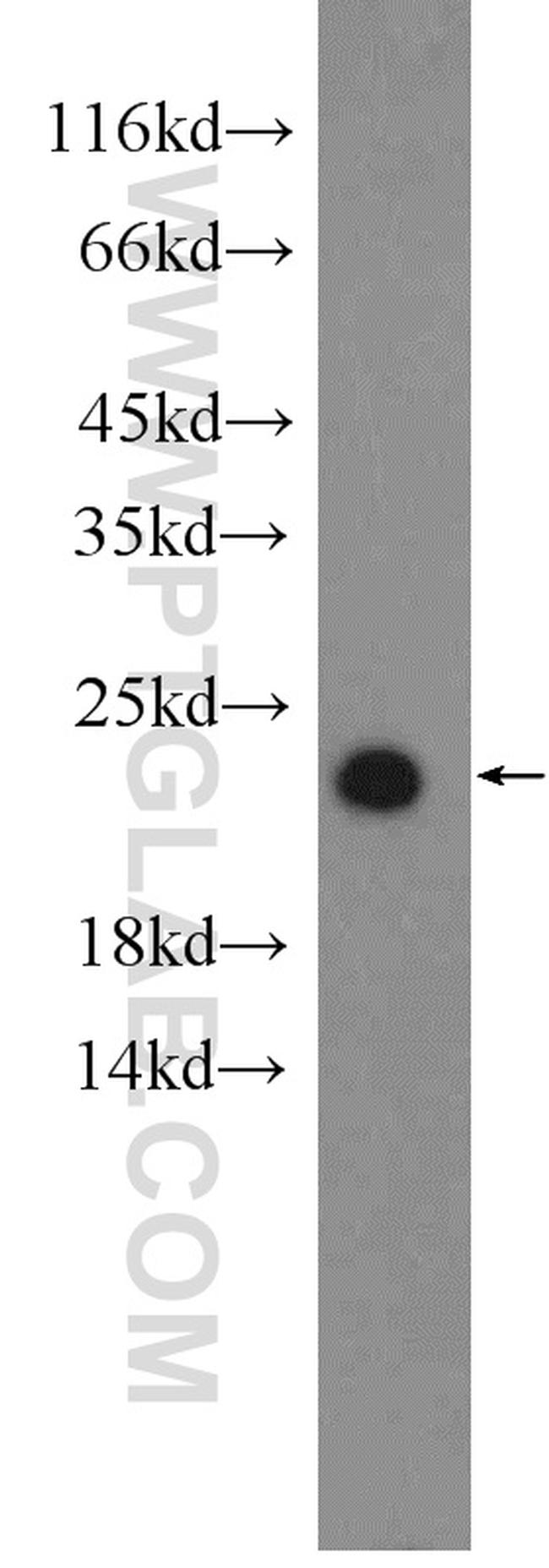 PRDX1 Antibody in Western Blot (WB)