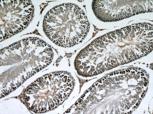 XRCC4 Antibody in Immunohistochemistry (Paraffin) (IHC (P))