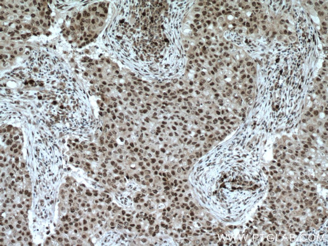 XRCC4 Antibody in Immunohistochemistry (Paraffin) (IHC (P))