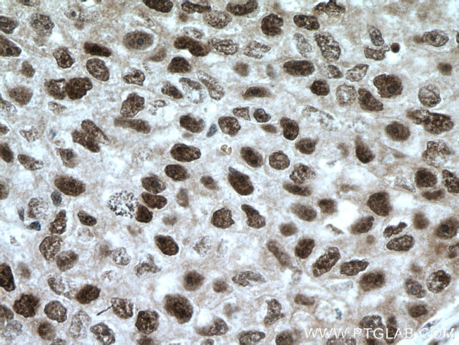 XRCC4 Antibody in Immunohistochemistry (Paraffin) (IHC (P))