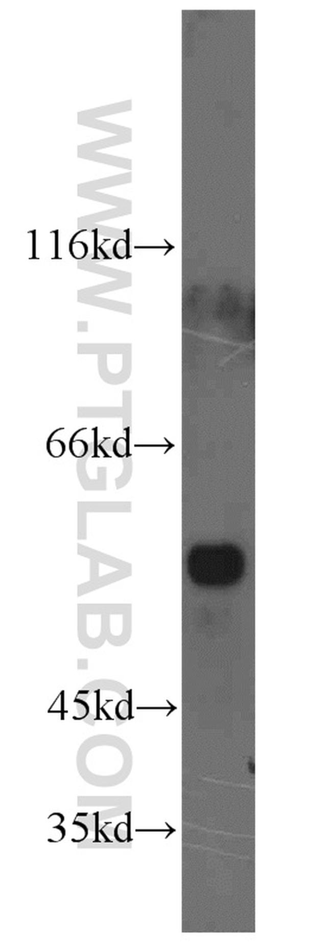 XRCC4 Antibody in Western Blot (WB)