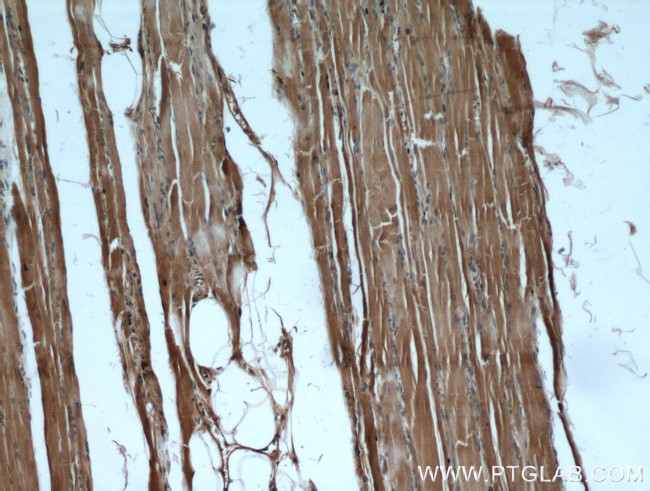 PKM1 Antibody in Immunohistochemistry (Paraffin) (IHC (P))