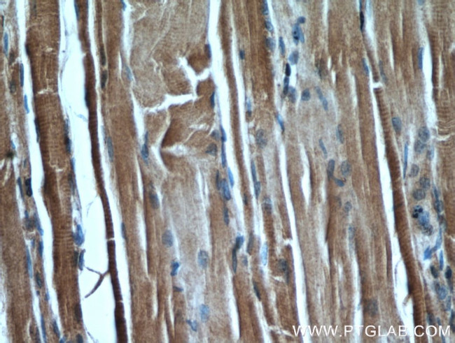 PKM1 Antibody in Immunohistochemistry (Paraffin) (IHC (P))