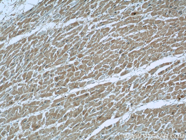 PKM1 Antibody in Immunohistochemistry (Paraffin) (IHC (P))