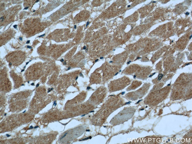 PKM1 Antibody in Immunohistochemistry (Paraffin) (IHC (P))