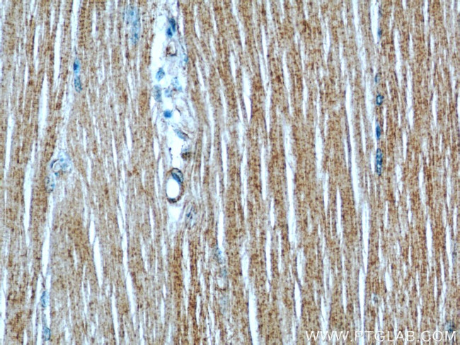 PKM1 Antibody in Immunohistochemistry (Paraffin) (IHC (P))