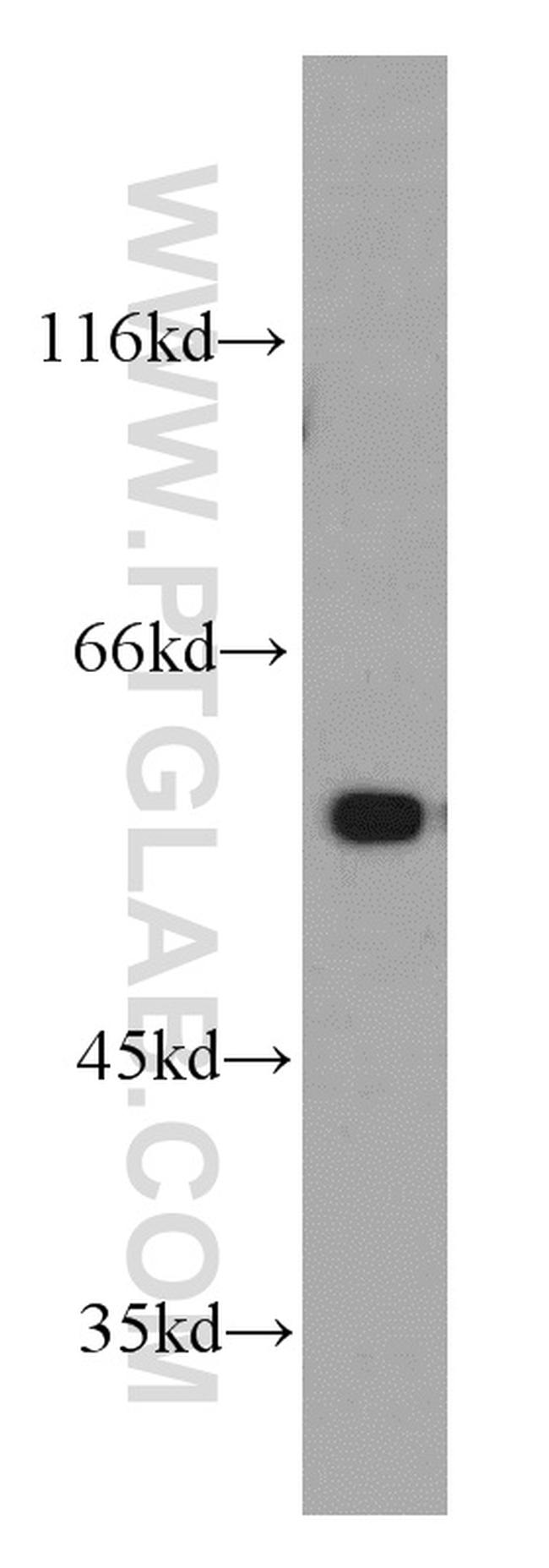 PKM1 Antibody in Western Blot (WB)