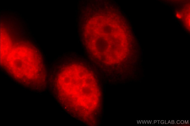 PKM1 Antibody in Immunocytochemistry (ICC/IF)