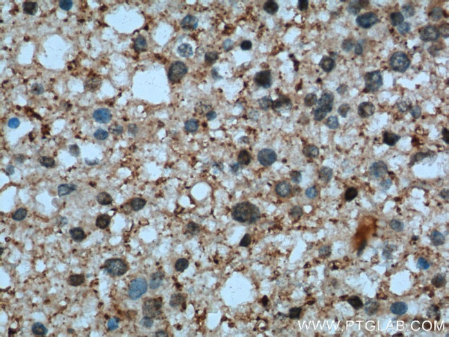 PKM1 Antibody in Immunohistochemistry (Paraffin) (IHC (P))