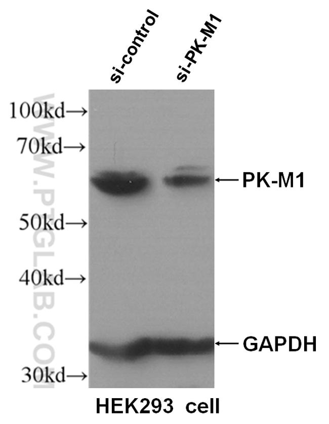 PKM1 Antibody in Western Blot (WB)