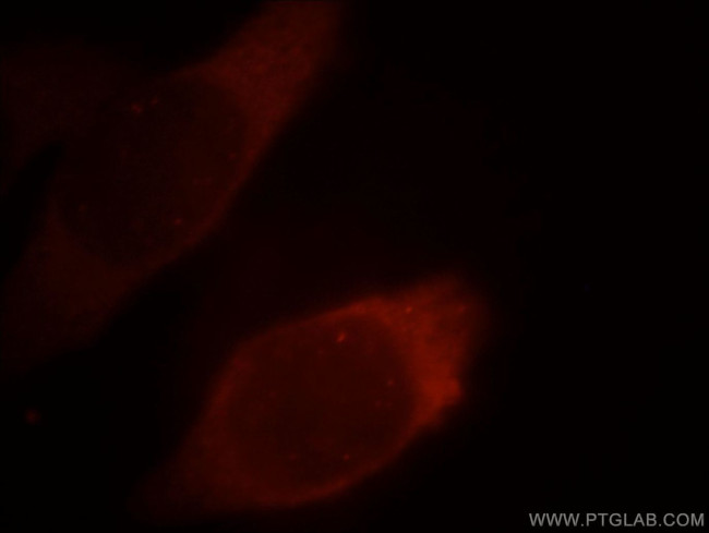 PKM2 Antibody in Immunocytochemistry (ICC/IF)