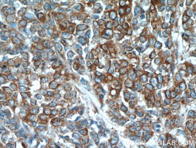 PKM2 Antibody in Immunohistochemistry (Paraffin) (IHC (P))