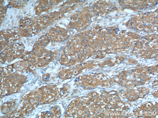 PKM2 Antibody in Immunohistochemistry (Paraffin) (IHC (P))