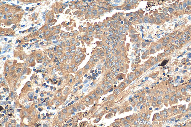 PKM2 Antibody in Immunohistochemistry (Paraffin) (IHC (P))