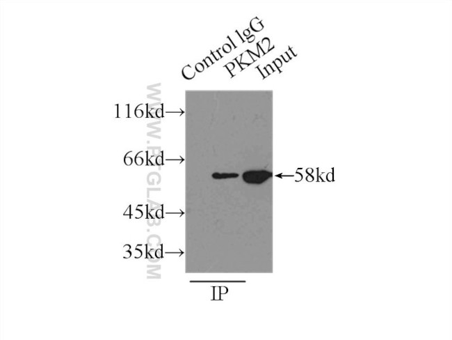 PKM2 Antibody in Immunoprecipitation (IP)