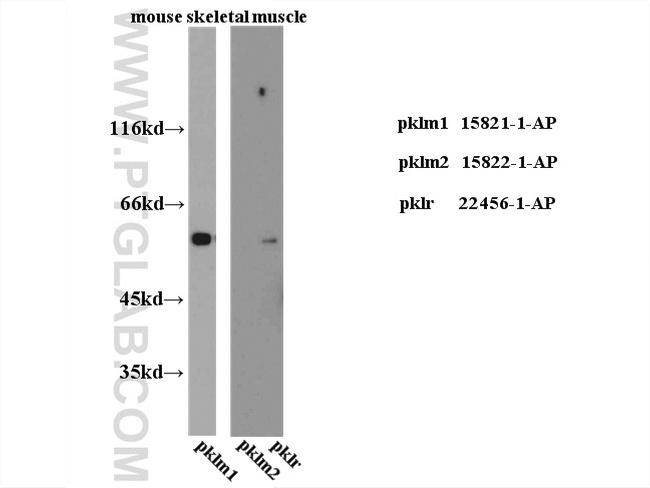 PKM2 Antibody in Western Blot (WB)