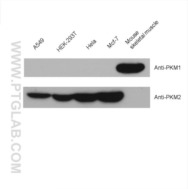 PKM2 Antibody in Western Blot (WB)