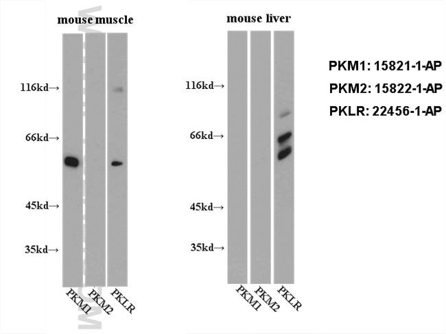 PKM2 Antibody in Western Blot (WB)