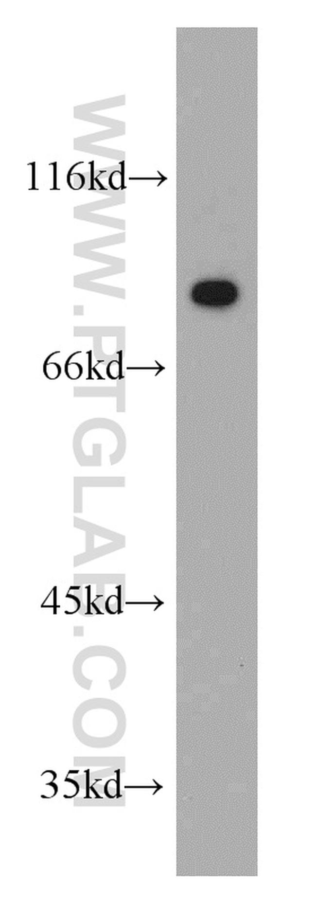 PKM2 Antibody in Western Blot (WB)