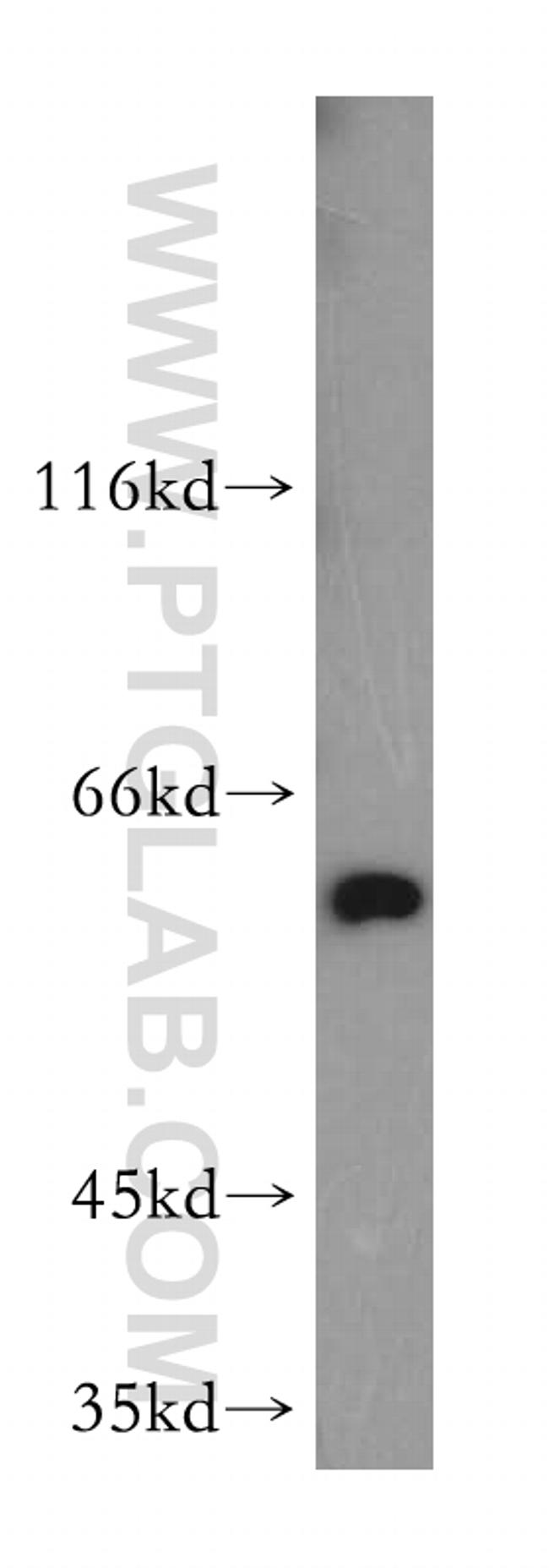 PKM2 Antibody in Western Blot (WB)