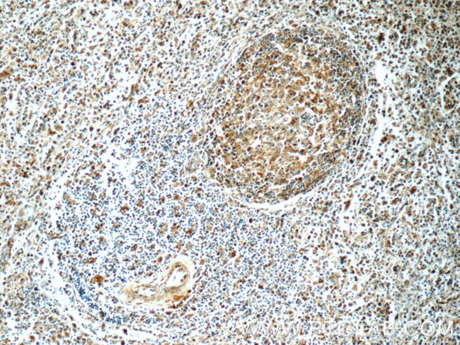 MCL1L Antibody in Immunohistochemistry (Paraffin) (IHC (P))