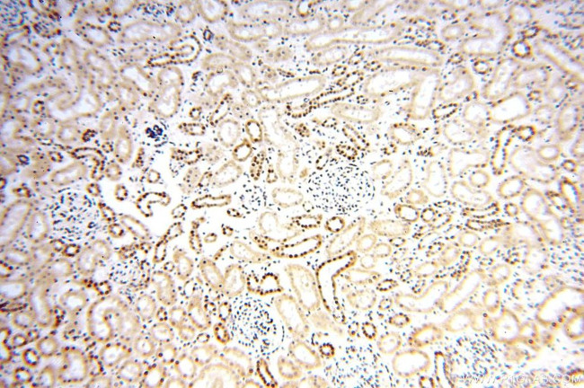 MCL1L Antibody in Immunohistochemistry (Paraffin) (IHC (P))