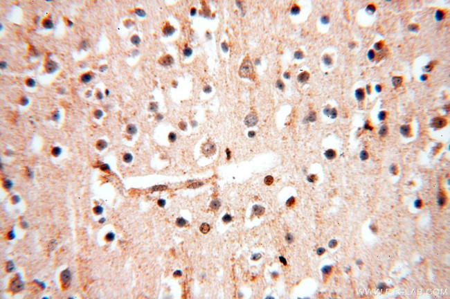 MCL1L Antibody in Immunohistochemistry (Paraffin) (IHC (P))