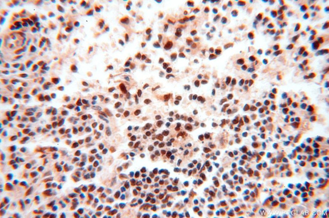 MCL1L Antibody in Immunohistochemistry (Paraffin) (IHC (P))
