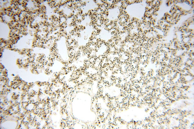 MCL1L Antibody in Immunohistochemistry (Paraffin) (IHC (P))