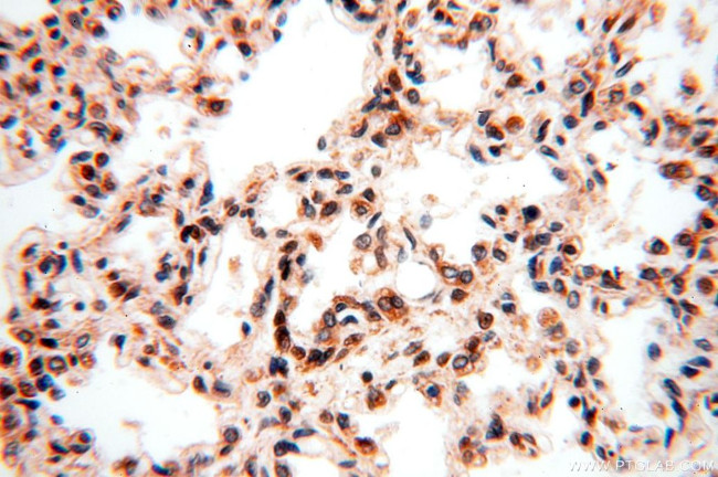 MCL1L Antibody in Immunohistochemistry (Paraffin) (IHC (P))