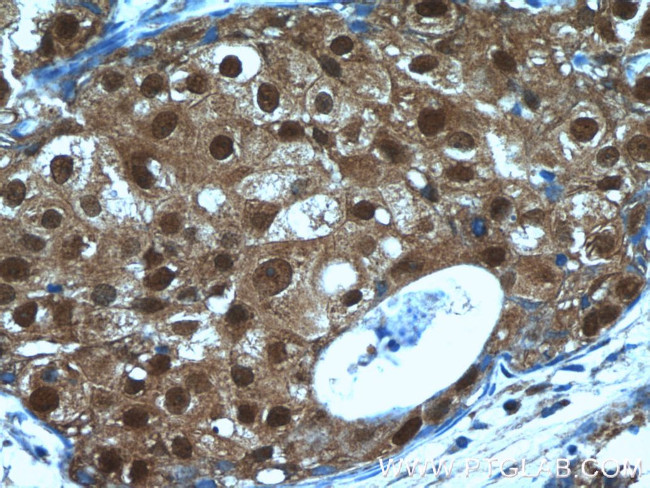 MCL1L Antibody in Immunohistochemistry (Paraffin) (IHC (P))