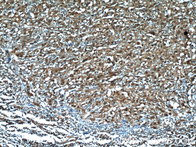 MCL1L Antibody in Immunohistochemistry (Paraffin) (IHC (P))