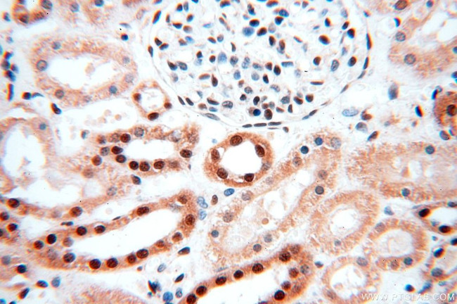 MCL1L Antibody in Immunohistochemistry (Paraffin) (IHC (P))