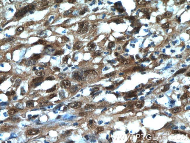 MCL1L Antibody in Immunohistochemistry (Paraffin) (IHC (P))