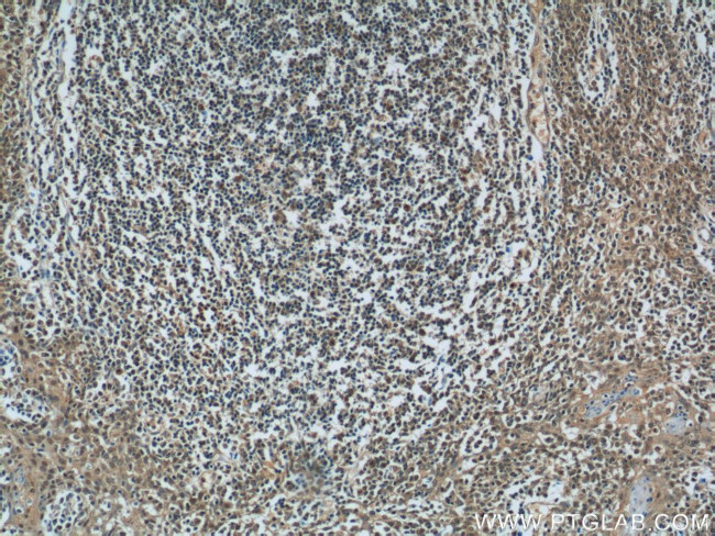 MCL1L Antibody in Immunohistochemistry (Paraffin) (IHC (P))